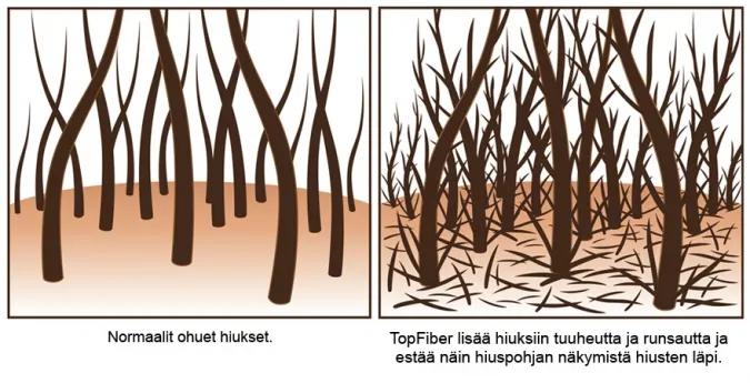 TopFiber Elektroninen hiuskuitusumutin